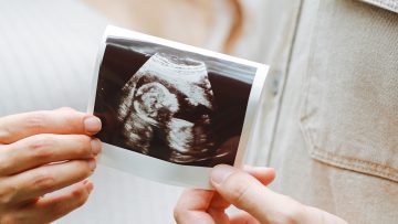 Bioethics in Brief